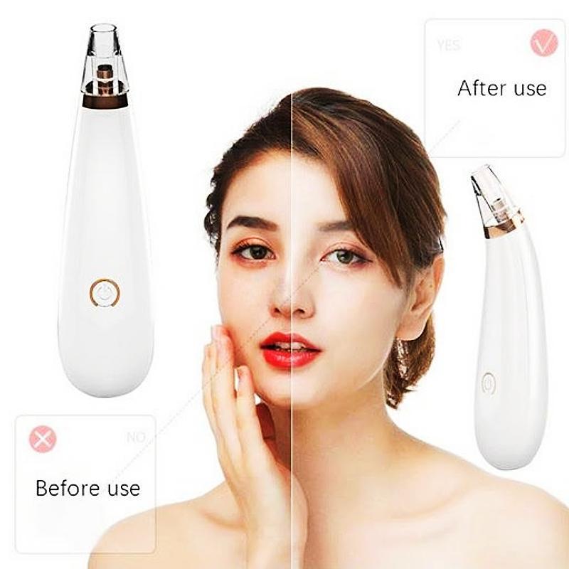 BUY 1 TAKE 1 Blackhead Remover Detector Vacuum Suction Blackhead Acne Extractor Pores Deeply Cleaning BUY 1 TAKE 1 Blackhead Remover Detector Vacuum Suction Blackhead Acne Extractor Pores Deeply Cleaning